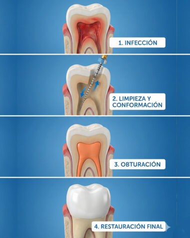 eNDODONCIA